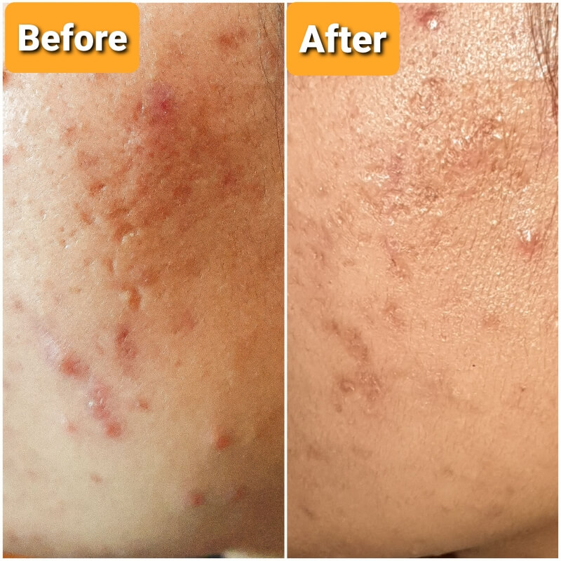 Pemakaian 1x sehari, setelah 2 minggu